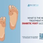 What Is the New Treatment for Diabetic Foot Ulcers?