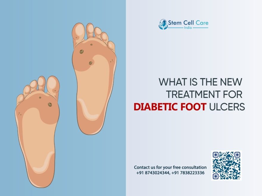 What Is the New Treatment for Diabetic Foot Ulcers?