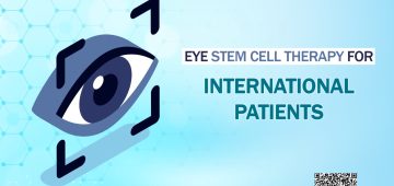 Eye Stem Cell Therapy for International Patients