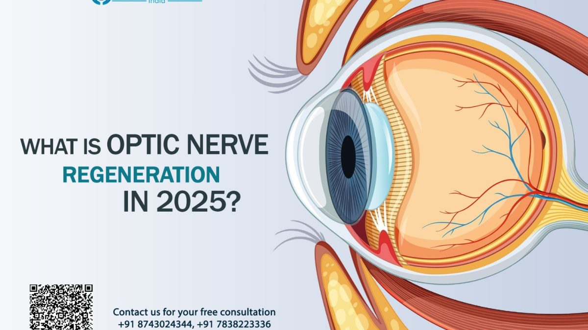What Is Optic Nerve Regeneration in 2025?