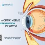 What Is Optic Nerve Regeneration in 2025?