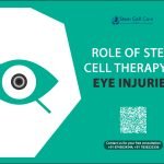 Role of Stem Cell Therapy in Eye Injuries
