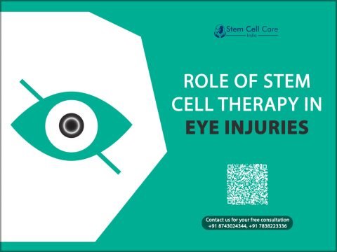 Role of Stem Cell Therapy in Eye Injuries