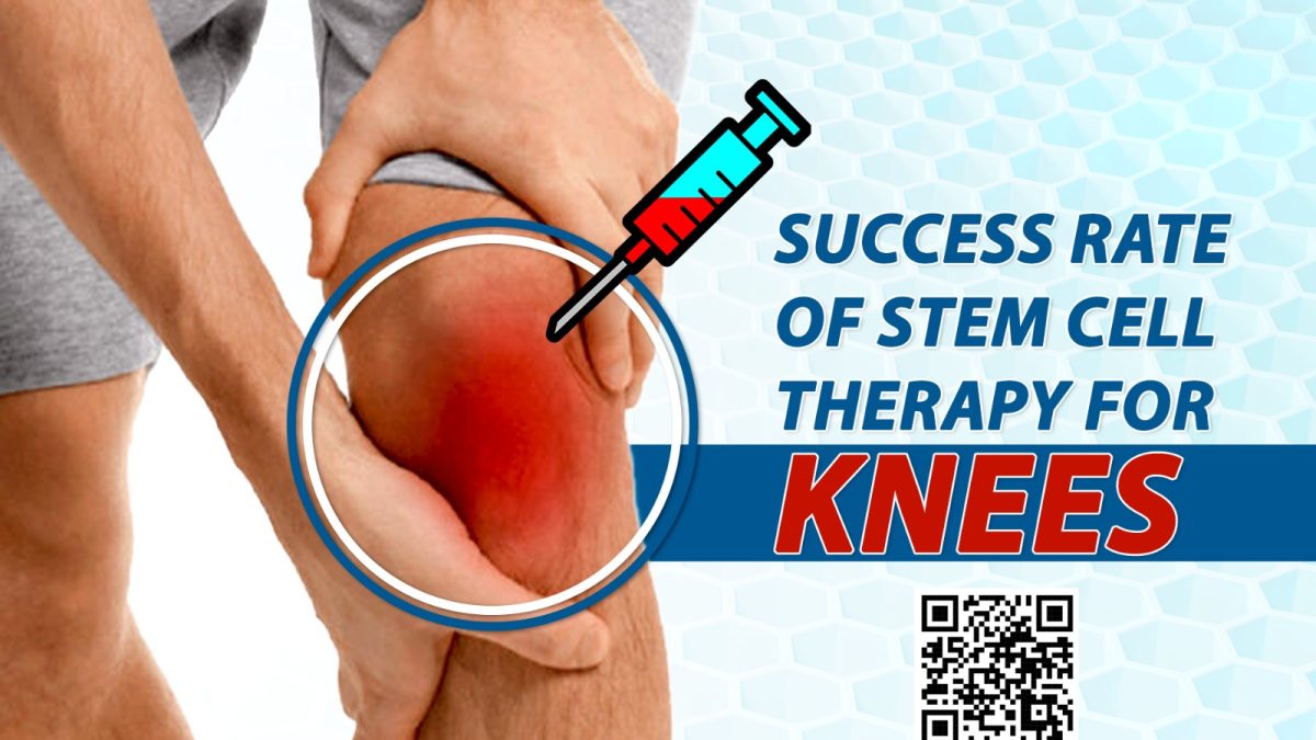 Success Rate of Stem Cell Therapy for Knees