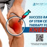 Success Rate of Stem Cell Therapy for Knees