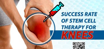 Success Rate of Stem Cell Therapy for Knees