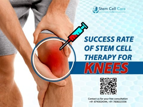 Success Rate of Stem Cell Therapy for Knees