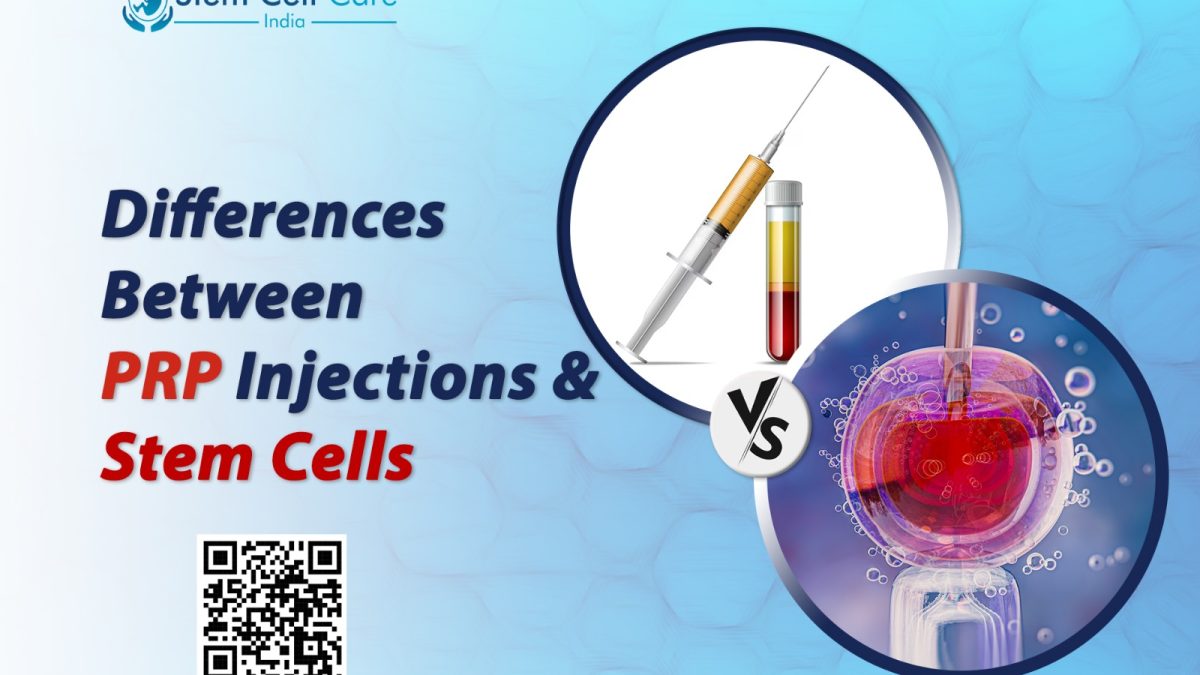 Differences Between PRP Injections and Stem Cells