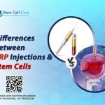 Differences Between PRP Injections and Stem Cells