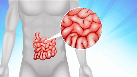 Stem Cell Treatment for Crohn’s Disease in India