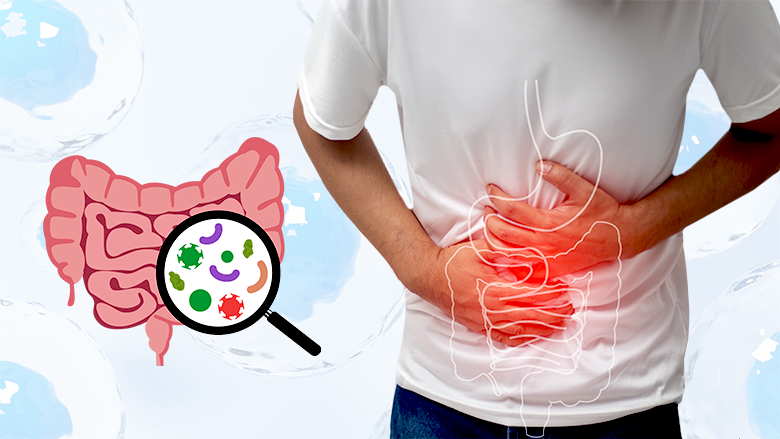 Stem Cell Treatment for Ulcerative Colitis
