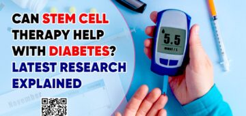 Can Stem Cell Therapy Help with Diabetes? Latest Research Explained