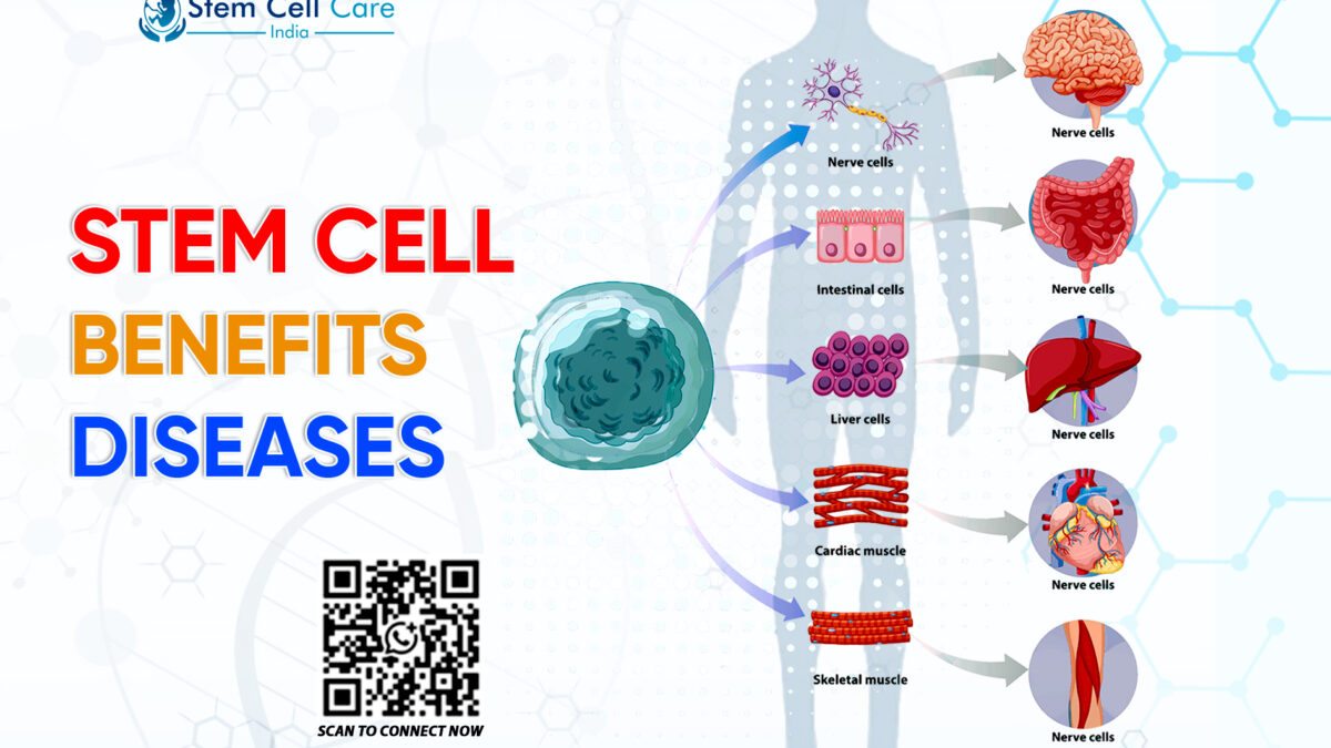 Stem Cell Benefits Diseases