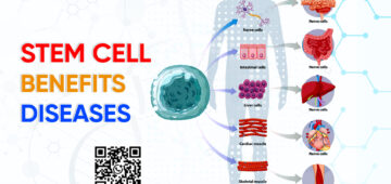 Stem Cell Benefits Diseases