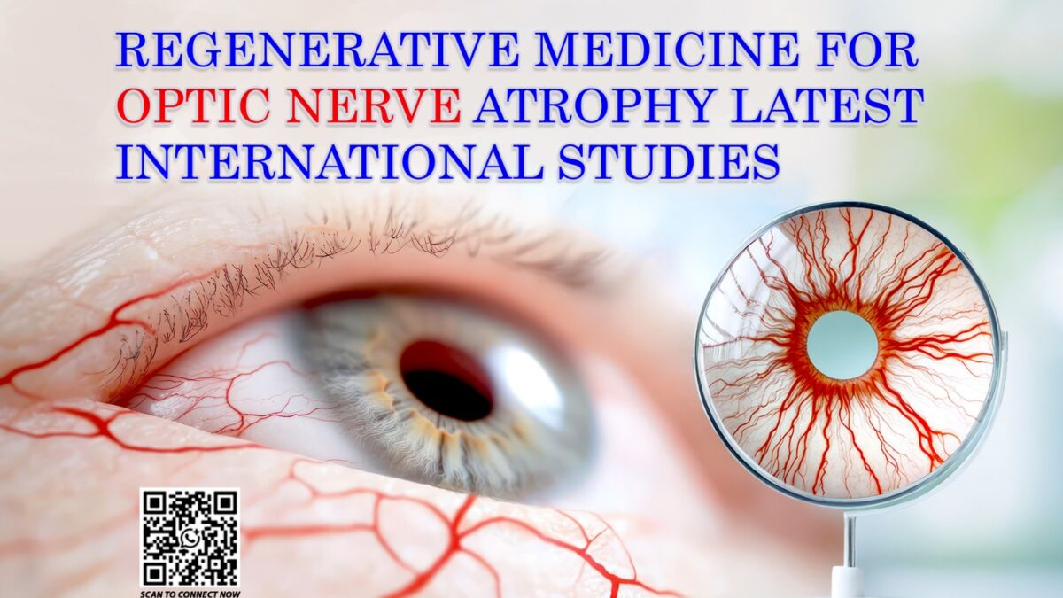 Regenerative Medicine for Optic Nerve Atrophy: Latest International Studies