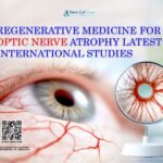 Regenerative Medicine for Optic Nerve Atrophy: Latest International Studies