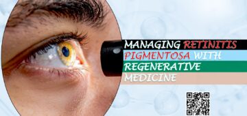 Managing Retinitis Pigmentosa with Regenerative Medicine