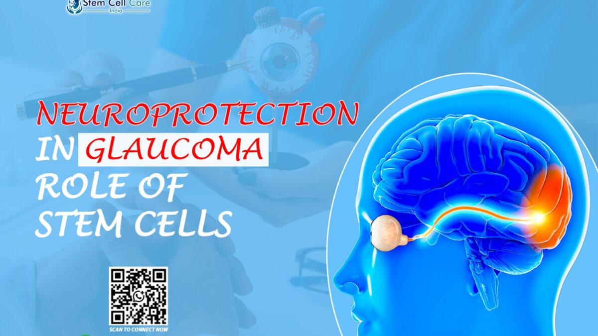 Neuroprotection in Glaucoma: Role of Stem Cells