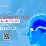 Neuroprotection in Glaucoma: Role of Stem Cells