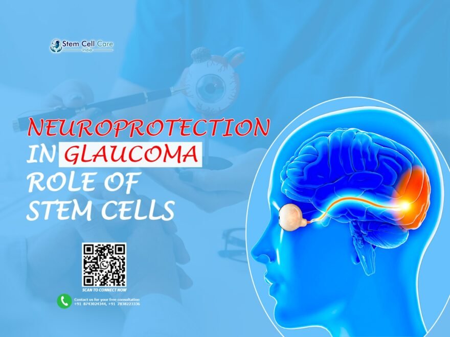 Neuroprotection in Glaucoma: Role of Stem Cells