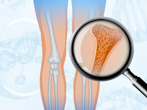 Bone Marrow Derived