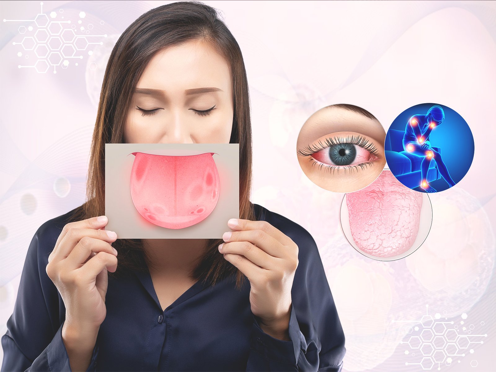 Stem Cell Treatments for Sjogren’s Syndrome