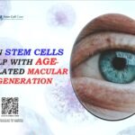 Can Stem Cells Help with Age-Related Macular Degeneration