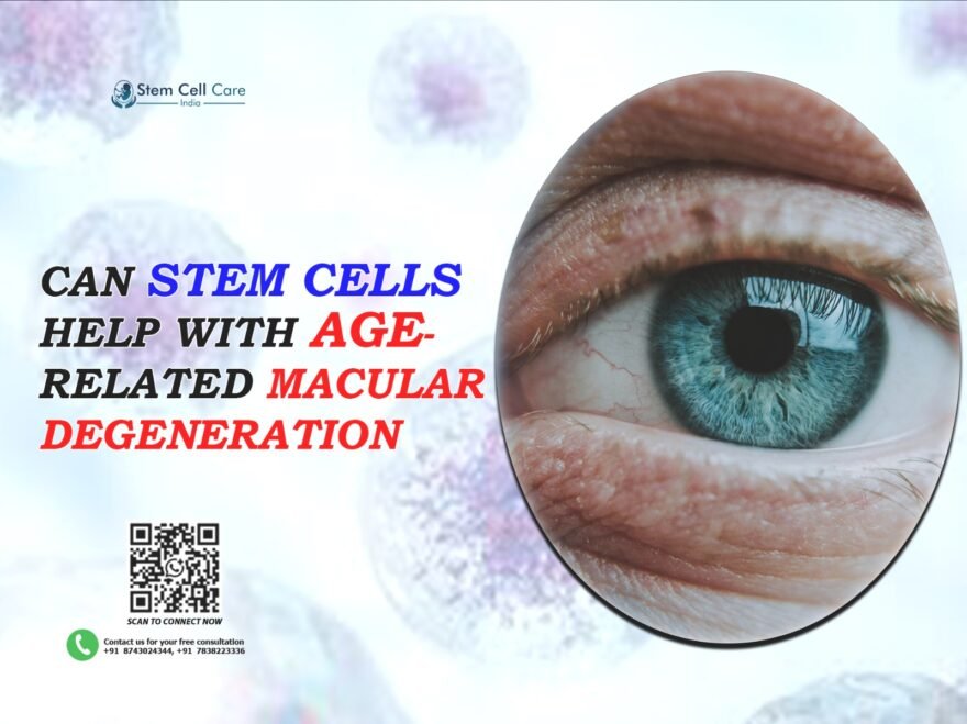 Can Stem Cells Help with Age-Related Macular Degeneration