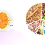 Diet Tips For Age-Related Macular Degeneration Patient