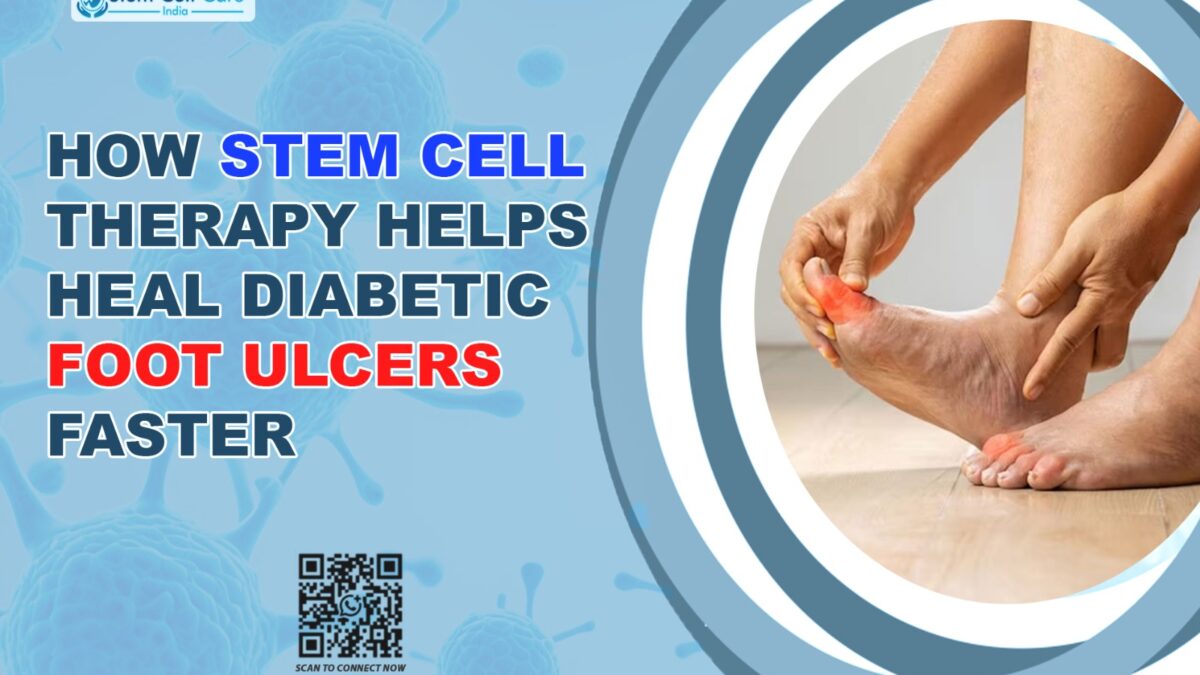 Stem cell therapy