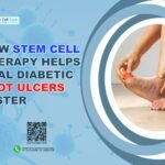 Stem cell therapy