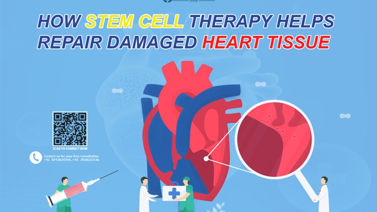 Stem Cell Therapy