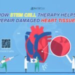 Stem Cell Therapy