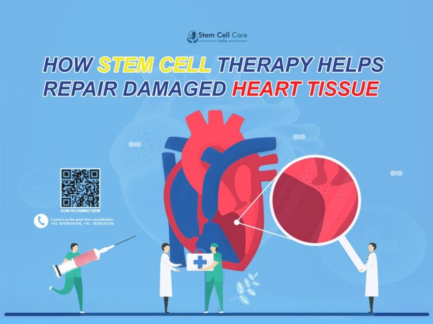 Stem Cell Therapy