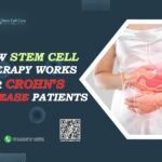Stem Cell Therapy