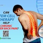 Stem Cell Therapy
