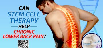 Stem Cell Therapy
